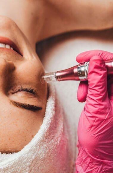 Dermapen o Microneedling