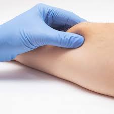 Resección de lipoma o quiste